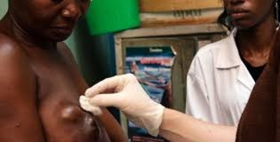RDC-Ituri : La peste bubonique fait déjà 96 victimes dont 10 décès 