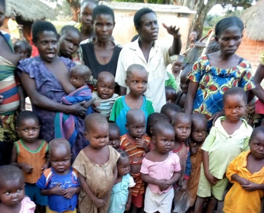 Kongo Central : Un SOS en faveur de 102 enfants frappés de malnutrition à Tshela